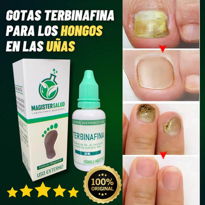 GOTAS DE TERBINAFINA - PARA HONGOS EN LAS UÑAS